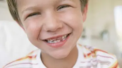 ¿Cuántos dientes pierden los niños?  Que esperar